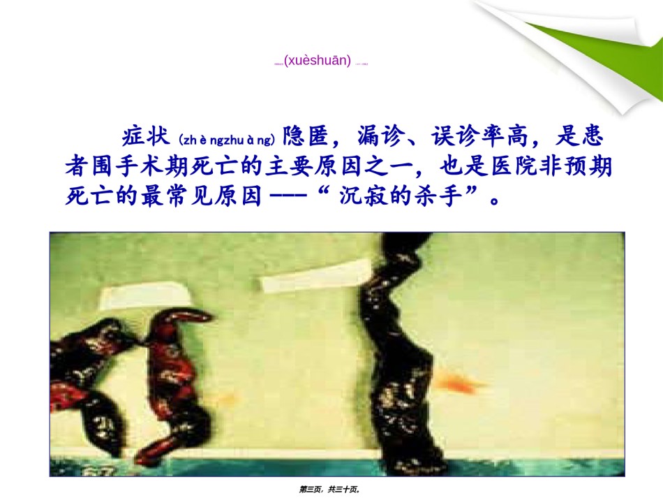 2022年医学专题—沉寂的杀手深静脉血栓.ppt_第3页