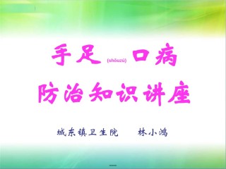 2022年医学专题—城东手足口病防治知识讲座.ppt