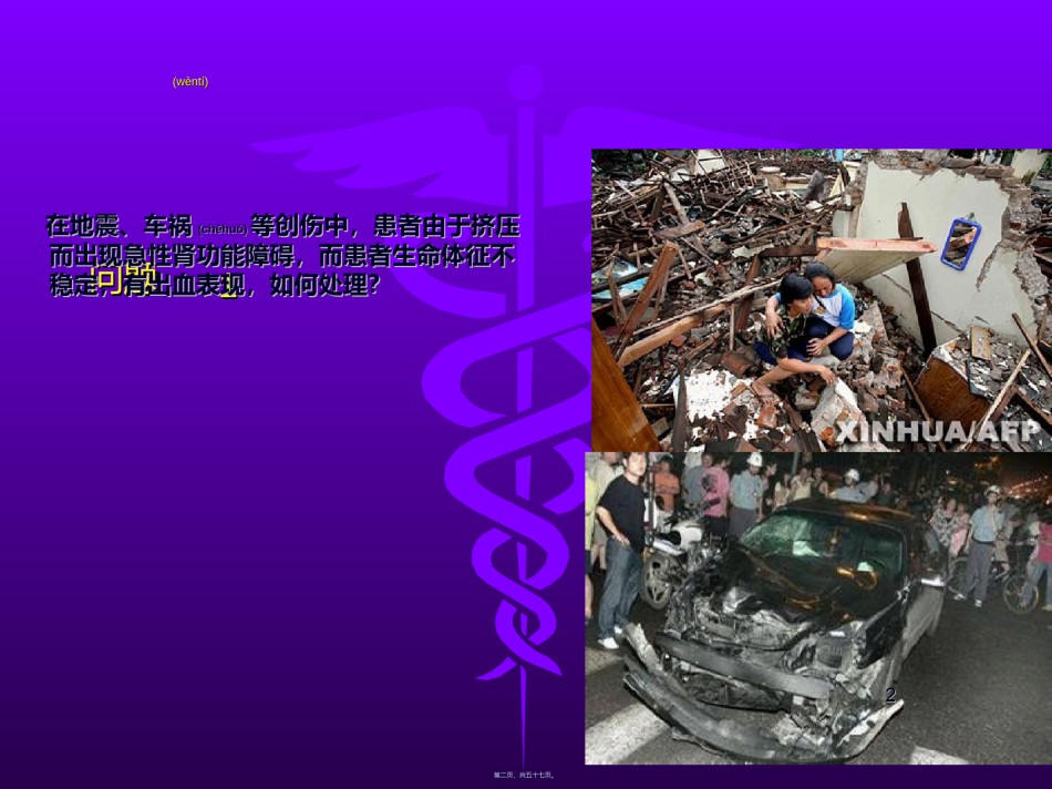 2022年医学专题—持续血液净化在危重病中的运用-2014.ppt_第2页
