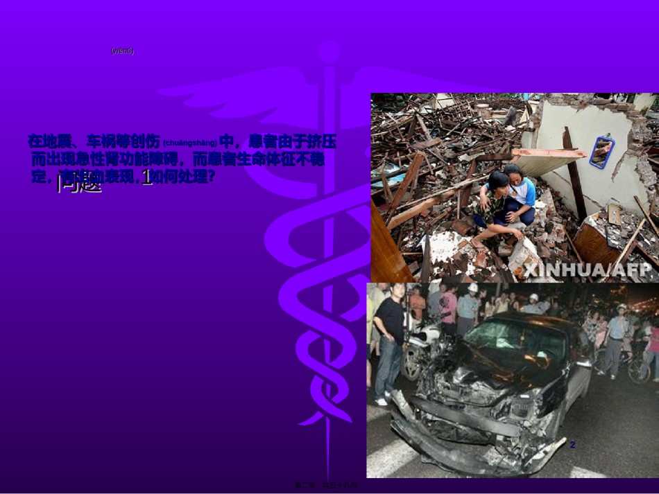 2022年医学专题—持续血液净化在危重病中的运用讲义.ppt_第2页