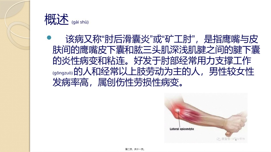 2022年医学专题—尺骨鹰嘴滑膜囊炎.pptx_第2页