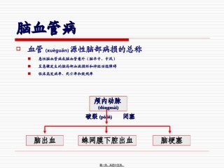2022年医学专题—出血性脑血管病s-PPT文档.ppt
