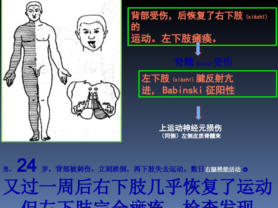 2022年医学专题—传导路病例讨论简述.ppt_第2页