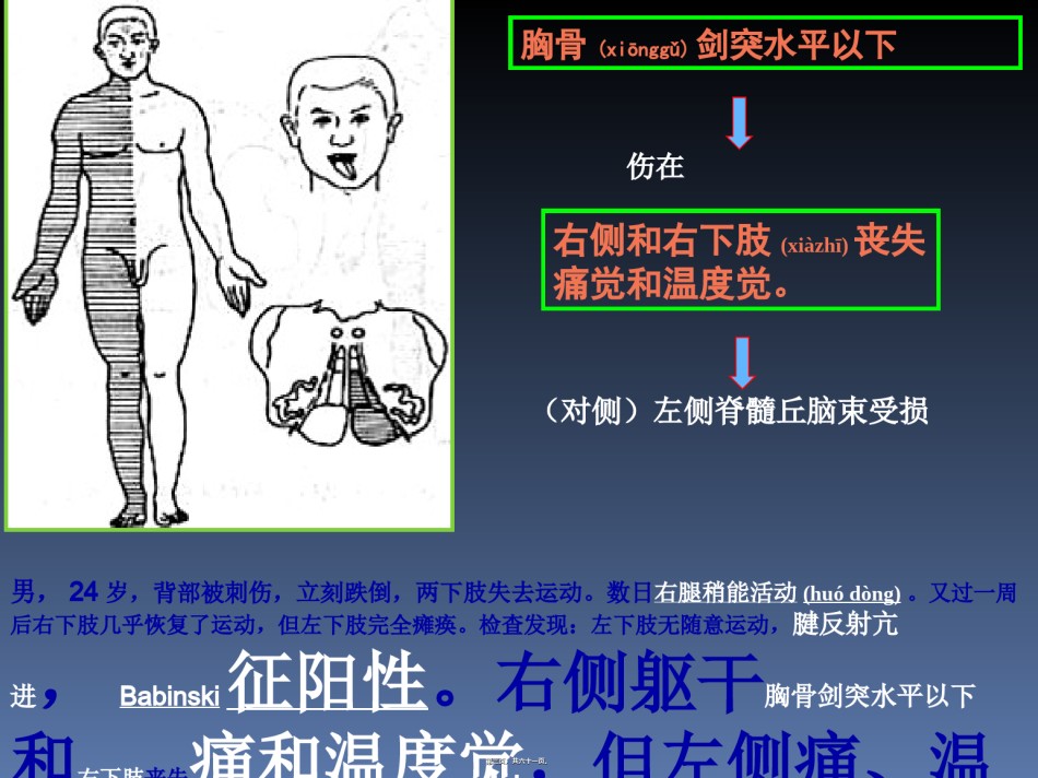 2022年医学专题—传导路病例讨论简述.ppt_第3页