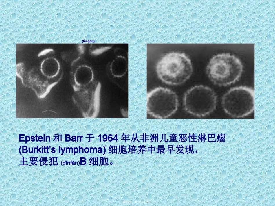 2022年医学专题—传染性单核细胞增多症-夏雅.ppt_第3页