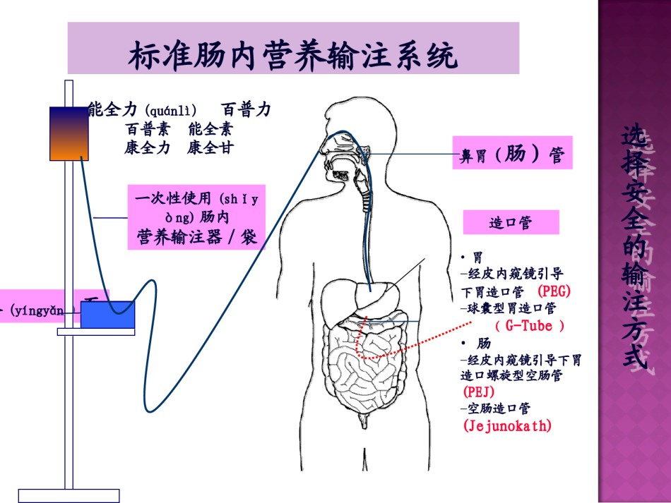 2022年医学专题—肠内营养并发症处理.ppt_第2页
