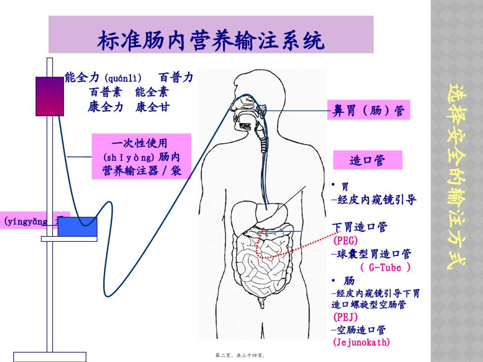 2022年医学专题—肠内营养并发症处理.pptx_第2页