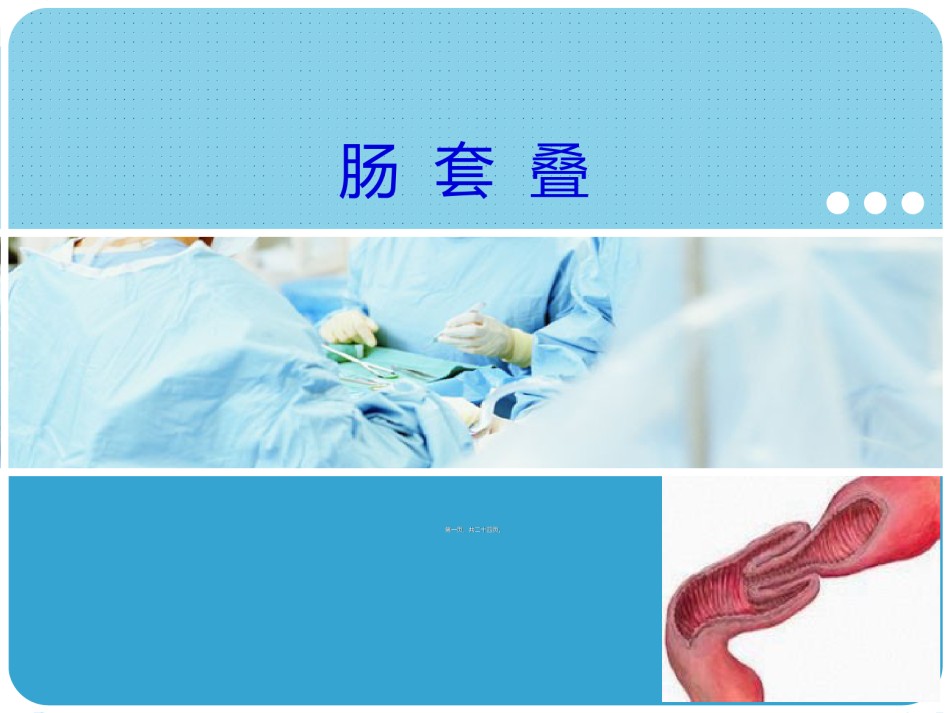 2022年医学专题—肠套叠.ppt_第1页