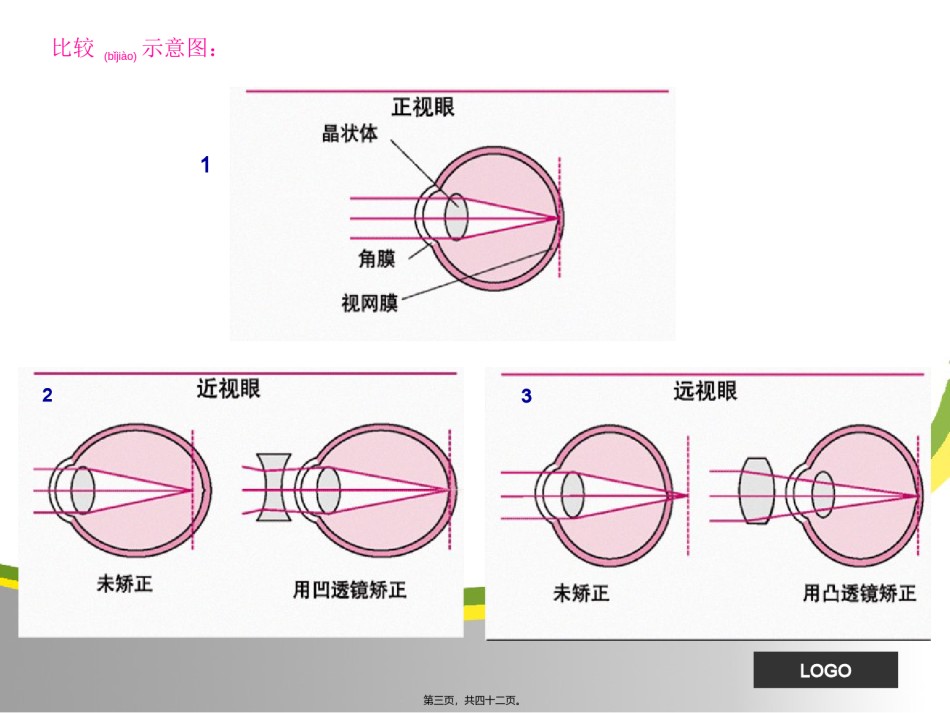 2022年医学专题—常见病知识(1)-修订稿.ppt_第3页