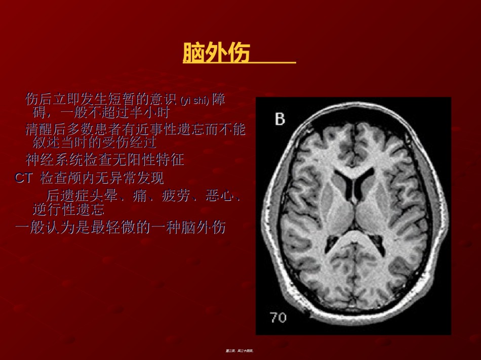 2022年医学专题—常见的脑外伤.ppt_第2页