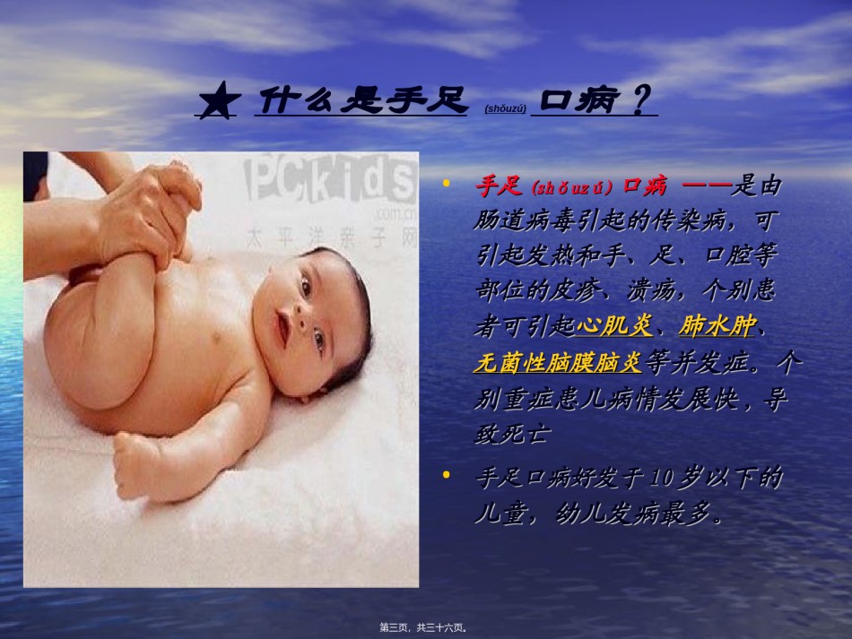 2022年医学专题—常见呼吸道传染病和手足口病知识讲座.ppt_第3页