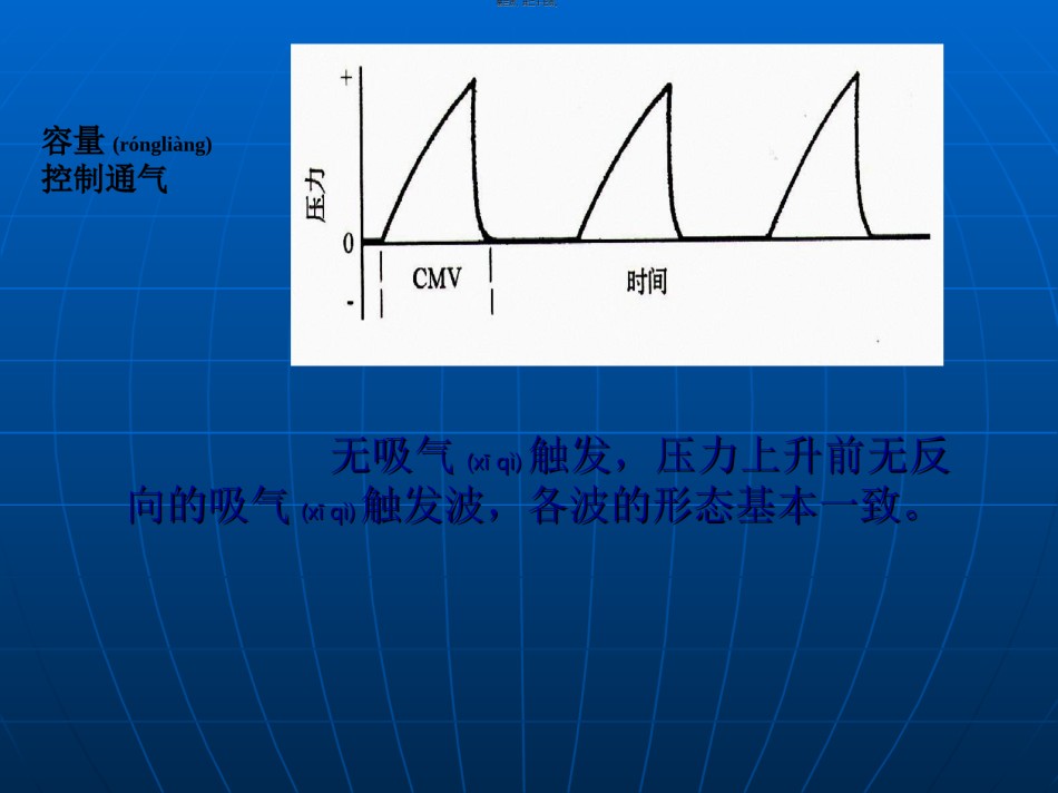 2022年医学专题—常见呼吸模式与参数设置.ppt_第3页