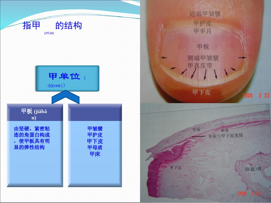 2022年医学专题—常见皮肤病的指甲表现.ppt_第2页
