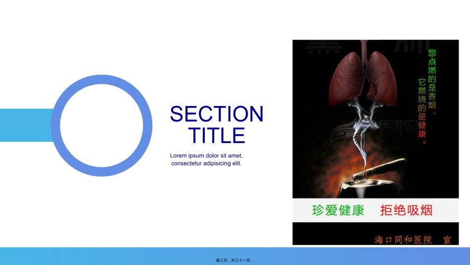 2022年医学专题—创建无烟医院.pptx_第3页