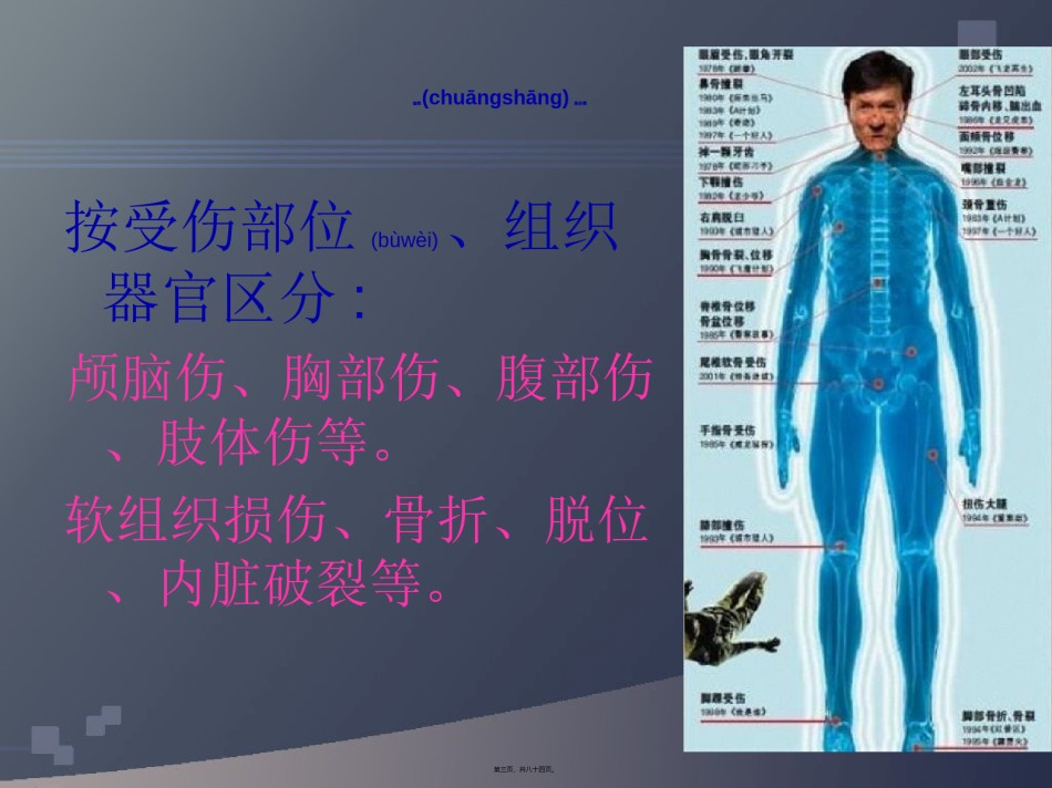 2022年医学专题—创伤分类及急救基础.ppt_第3页