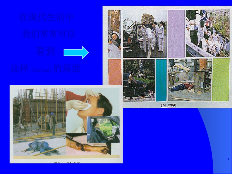 2022年医学专题—创伤现场救护.ppt_第3页