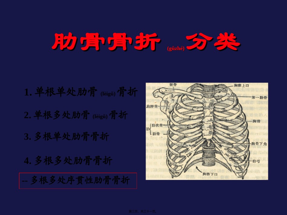 2022年医学专题—创伤性连枷胸合并ARDS.ppt_第3页