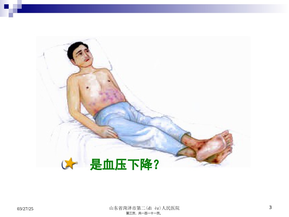 2022年医学专题—创伤性休克救治.ppt_第3页