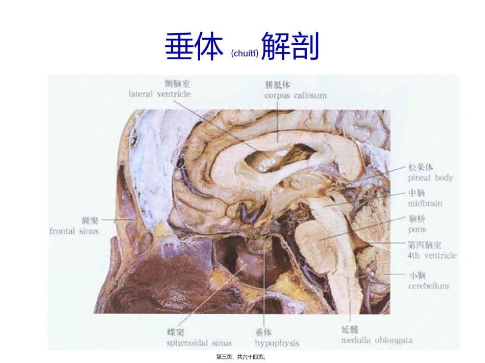 2022年医学专题—垂体瘤.pptx_第3页
