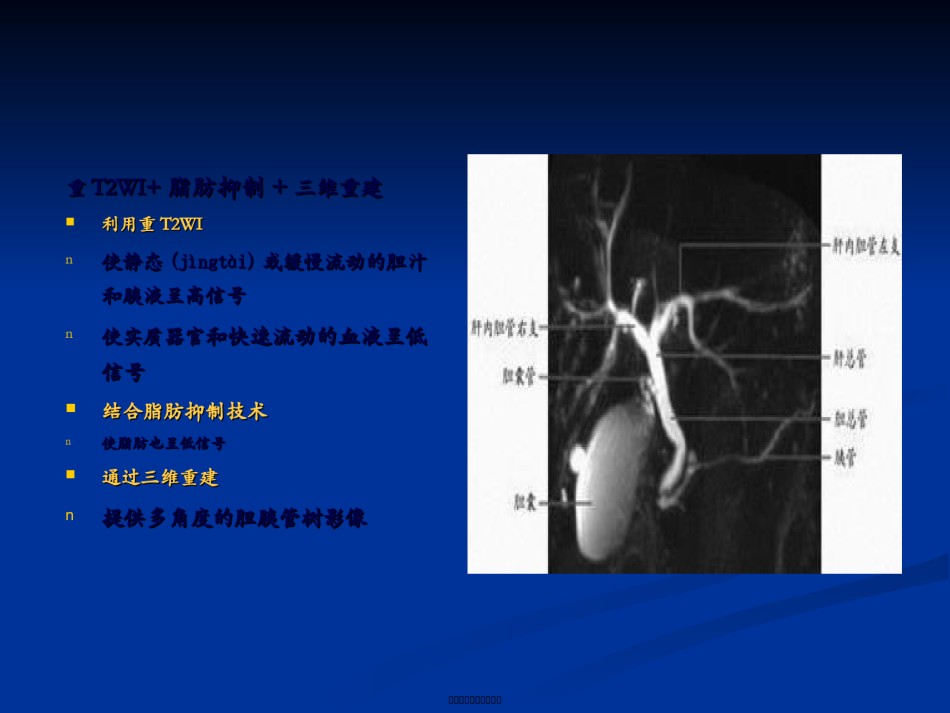 2022年医学专题—磁共振胆胰管成像.ppt_第3页