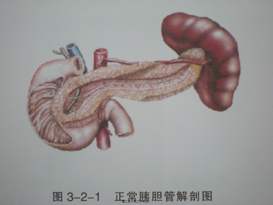 2022年医学专题—磁共振胰胆管成像.ppt_第2页