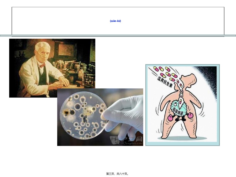 2022年医学专题—从呼吸医生角度谈碳氢酶烯类抗生素的合理使用.ppt_第3页