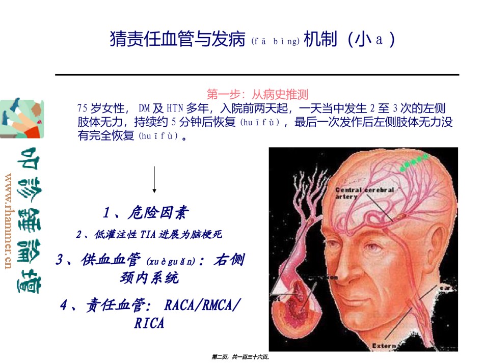 2022年医学专题—从影像学梗死部位推测责任供血血管.ppt_第2页