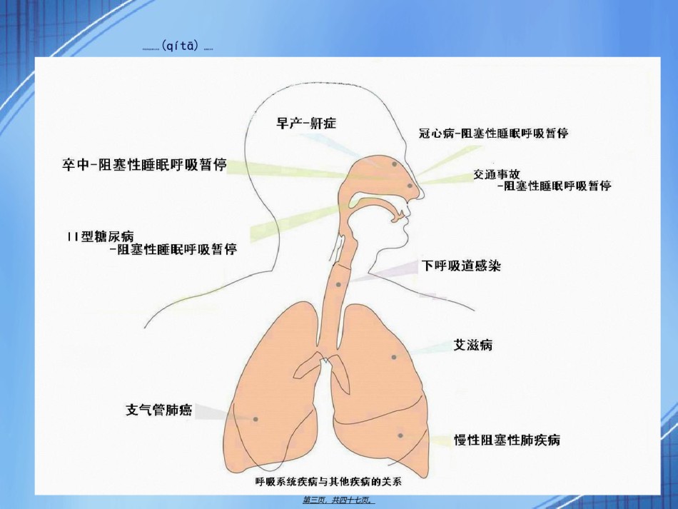 2022年医学专题—从WHO最近发布的全世界人口全因死亡率排序来看呼吸科医生的使命、责任和担当(精).ppt_第2页