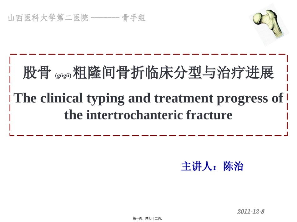 2022年医学专题—粗隆间骨折--cz.ppt_第1页