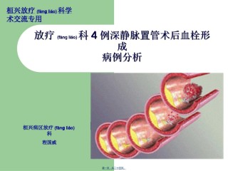 2022年医学专题—病例分析--放疗科4例深静脉置管后血栓分析.ppt