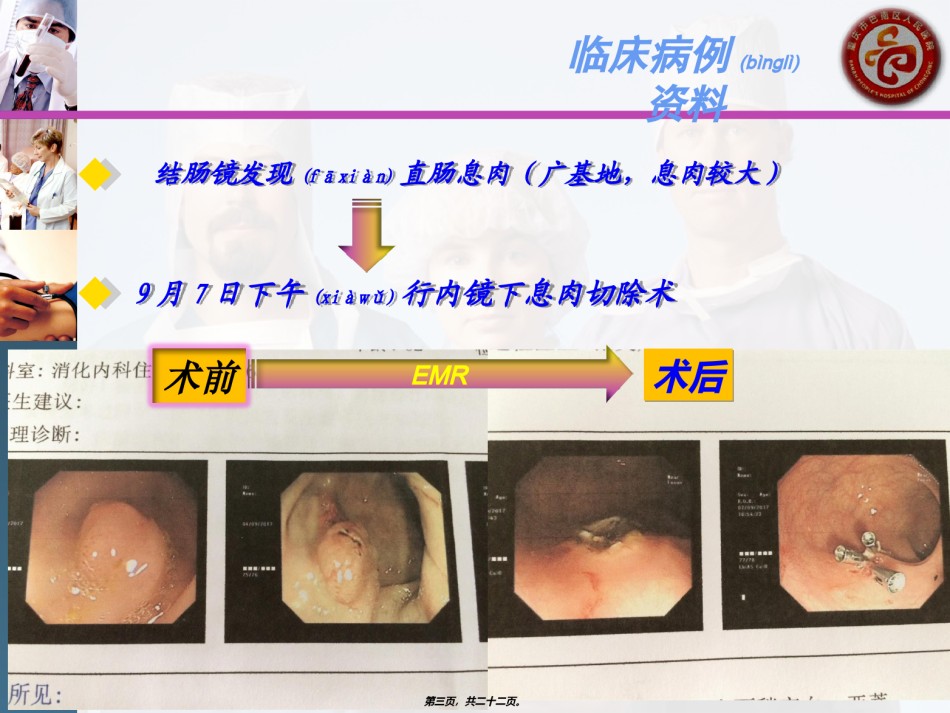 2022年医学专题—病例回顾分析.ppt_第3页