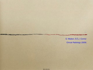 2022年医学专题—搏动性耳鸣的影像表现.ppt