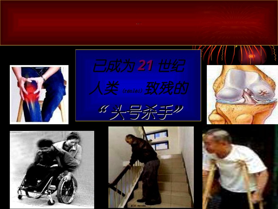 2022年医学专题—不死的癌症-骨关节病.ppt_第2页