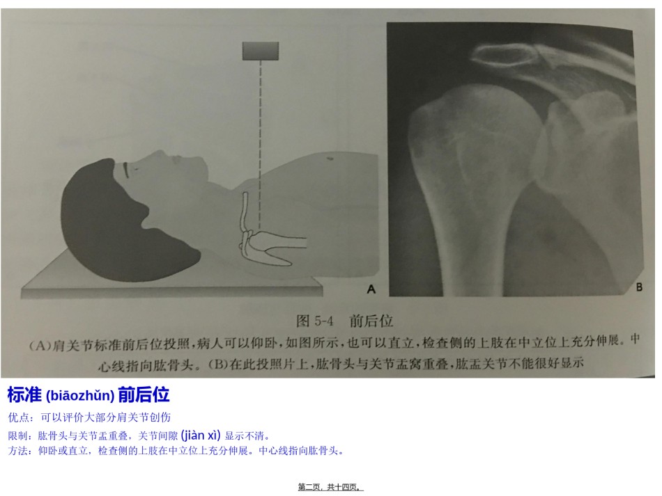 2022年医学专题—不同肩关节X线投照位.ppt_第2页