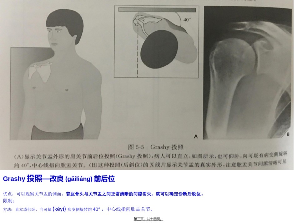 2022年医学专题—不同肩关节X线投照位.ppt_第3页