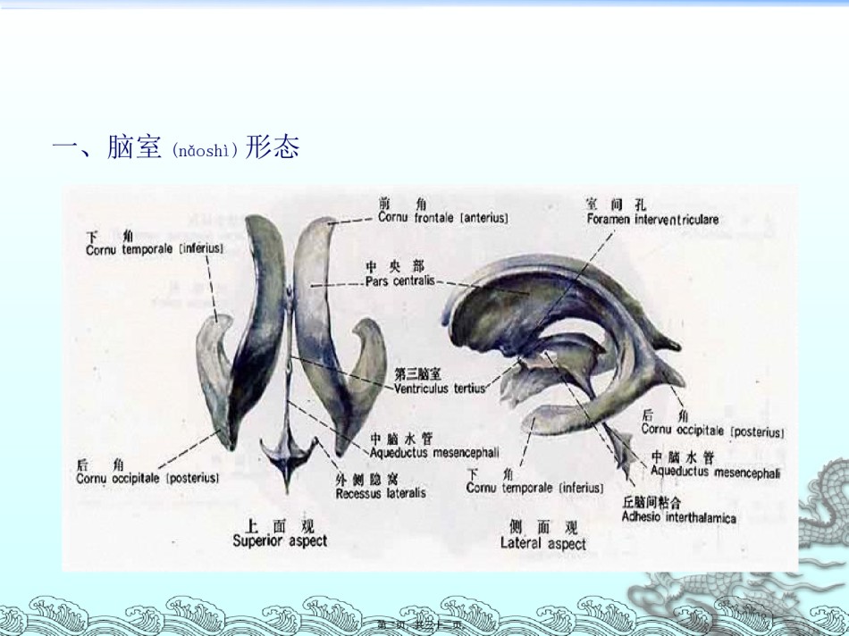 2022年医学专题—侧脑室穿刺术.ppt_第2页