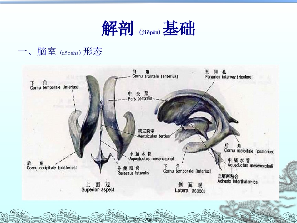 2022年医学专题—侧脑室穿刺术及脑脊液引流.ppt_第2页