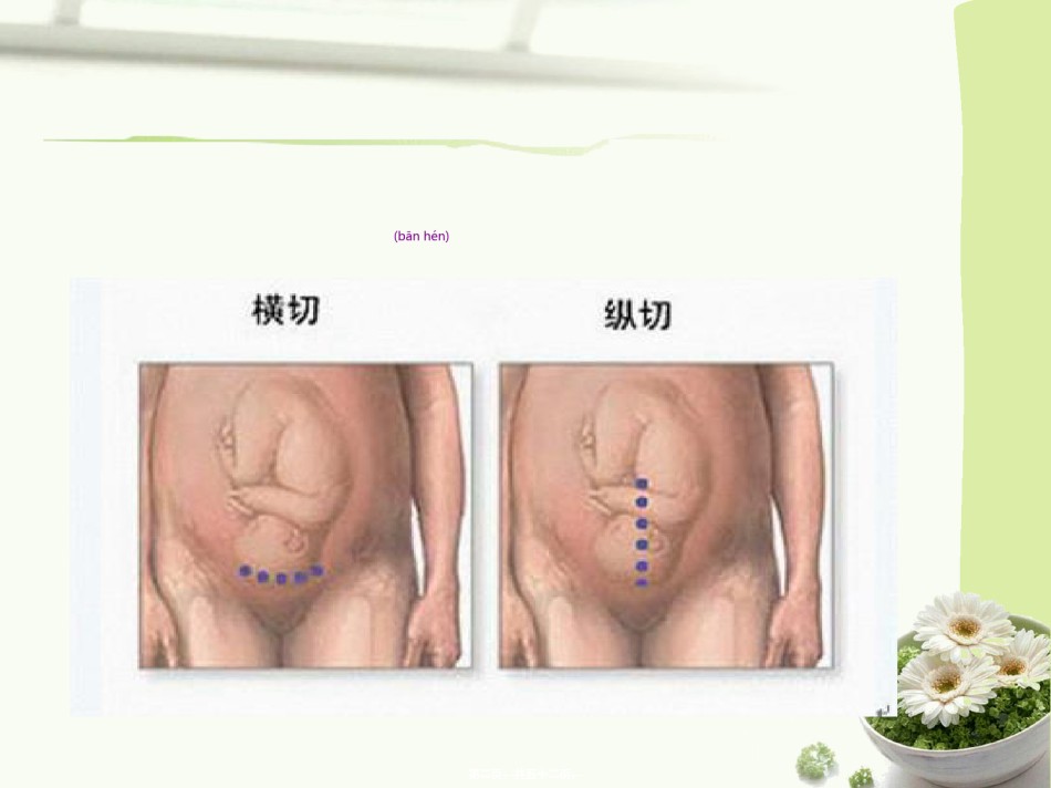 2022年医学专题—产后出血指南2014-镇海2015.ppt_第2页
