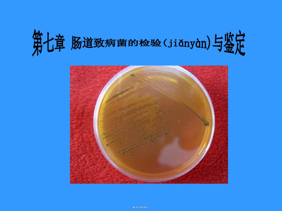 2022年医学专题—肠道致病菌检验简述.ppt_第1页