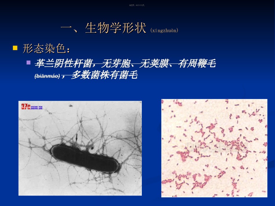 2022年医学专题—肠杆菌科(沙门菌属).ppt_第3页